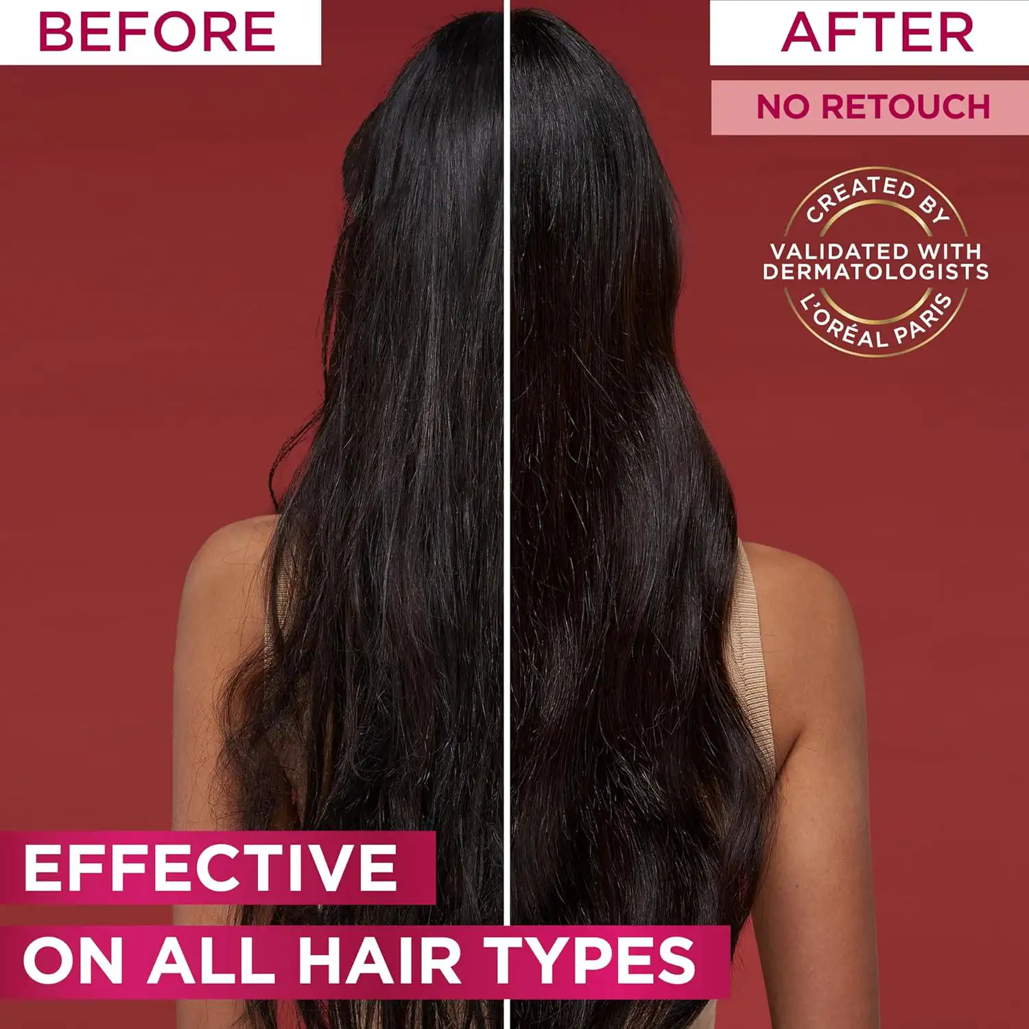 سيروم شعر لوريال ايلفيف امينكسيل ضد تساقط الشعر، 102 مل