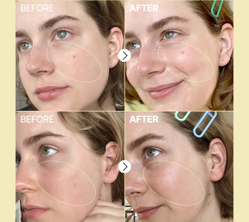 سيروم فيتامين سي 23 كوزراكس سيروم للبشرة، 20 مل.