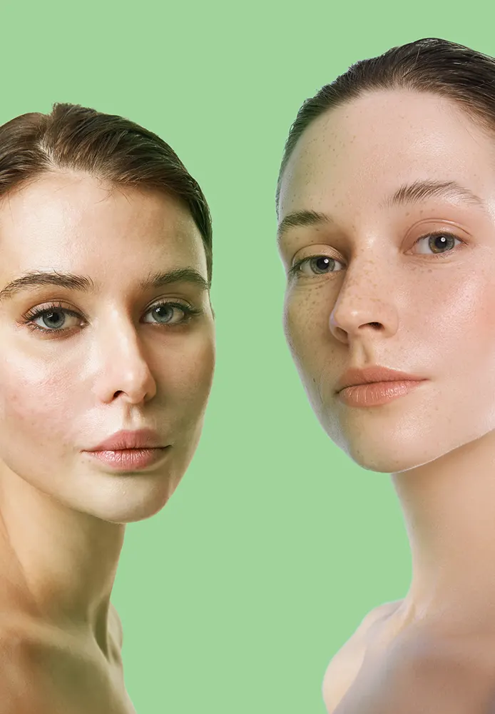 مرطب ديرما اكتيف اكتي كلير جلوبال ايه سي كريم جل مرطب للوجه، 50 مل