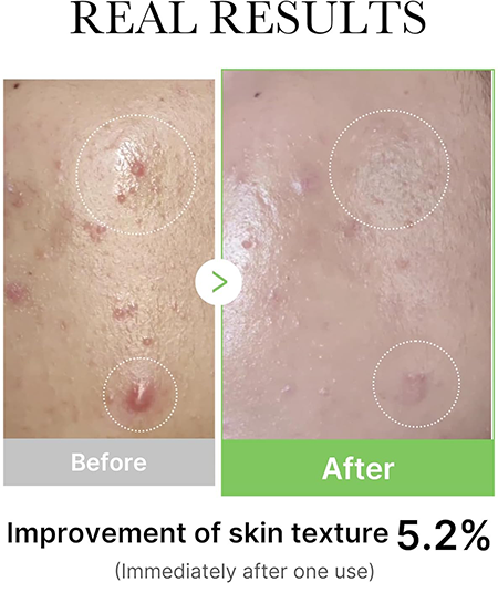 سيروم ميديكيوب اكسوسوم سيكا امبول سيروم للبشرة، 30 مل