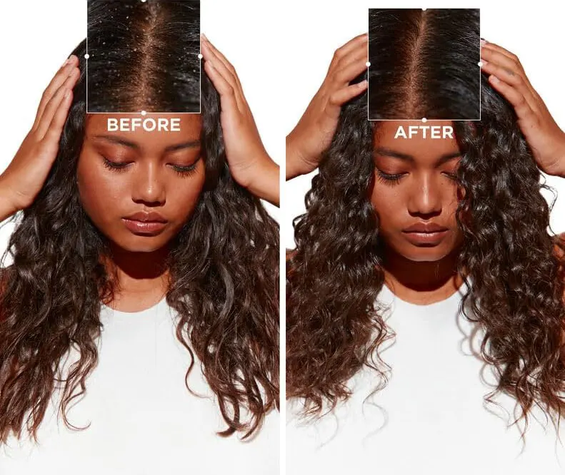 شامبو الشعر المضاد للقشره من سيكتور، 120 مل